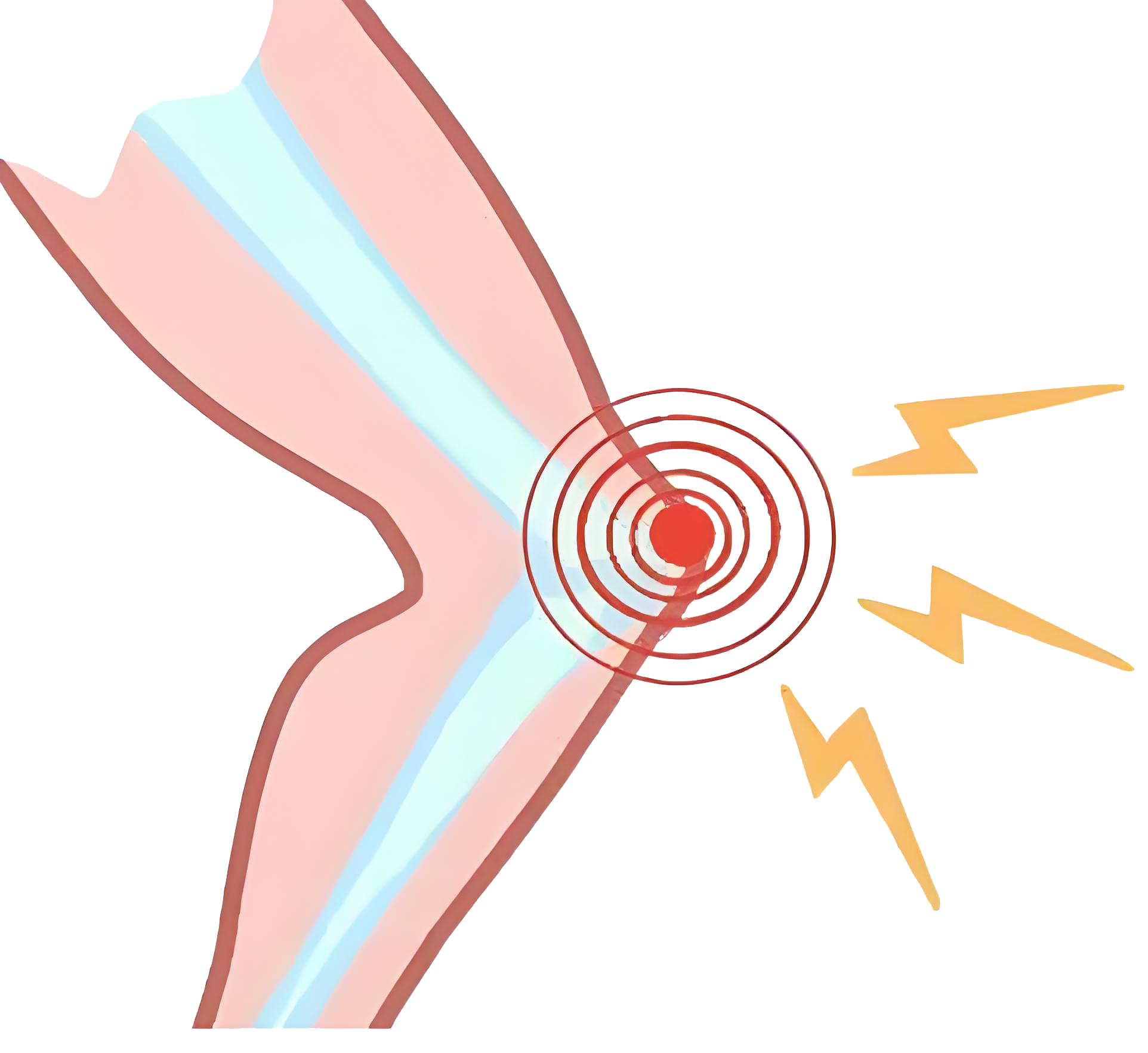 膝关节响声探秘：了解你的“关节BGM”